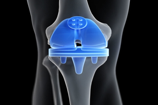 Life Orthopaedic Hospital | Cape Hip and Knee