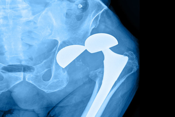 Life Orthopaedic Hospital | Cape Hip and Knee