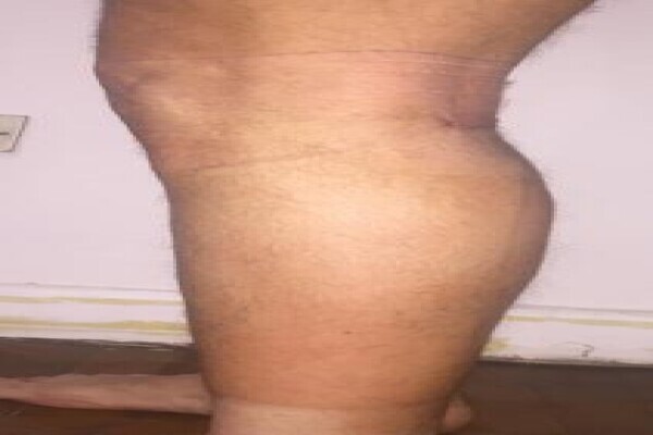 Leg enlargement ,hips and bums enlargement creams and pills call/whats app +256787681280