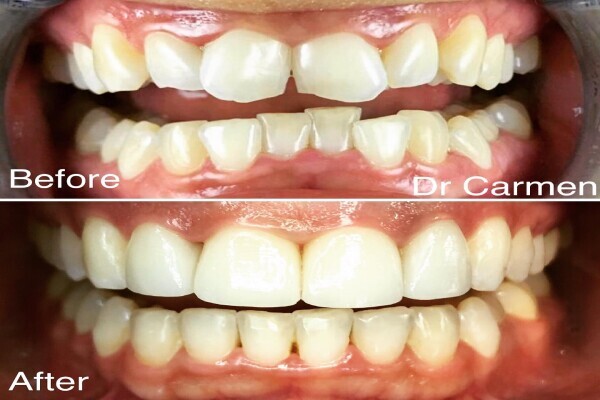 Dr Carmen Wilsenach Aesthetic Dentistry Practice