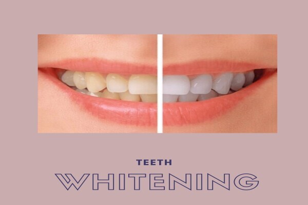 Dr Carmen Wilsenach Aesthetic Dentistry Practice