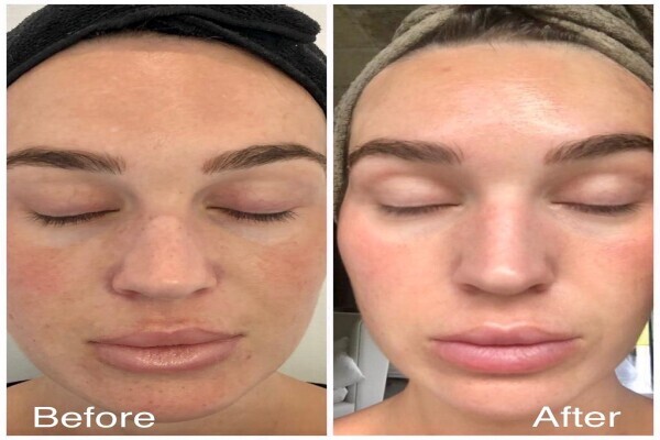 Dr Carmen Wilsenach Aesthetic Dentistry Practice