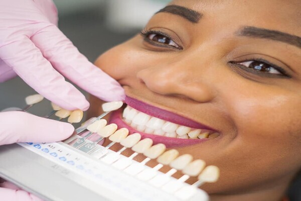 Zoom Whitening South Africa