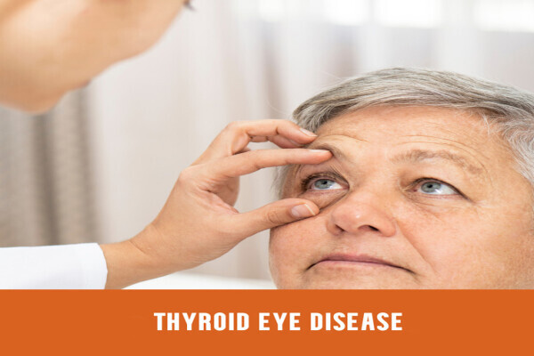 Dr. Marianthy Vayanos Ophthalmologist