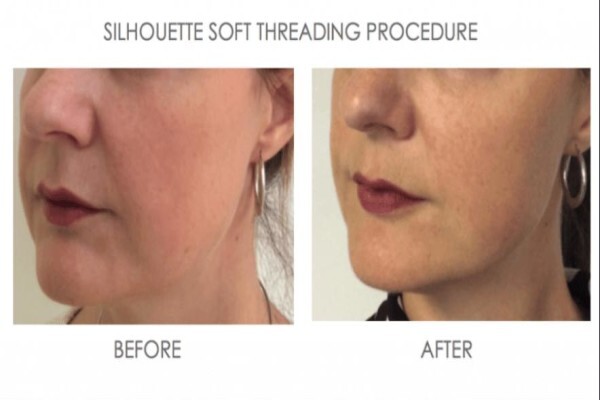 Skin & Body Renewal