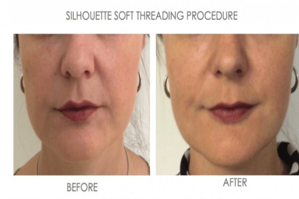 Skin & Body Renewal