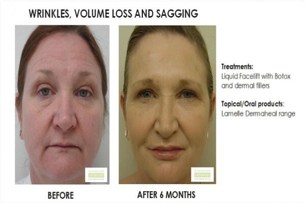 Skin & Body Renewal