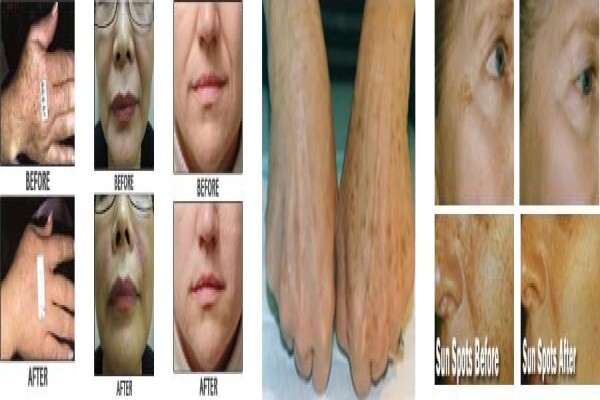 Slender Wonder Slimming