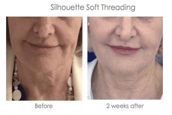 Skin Renewal