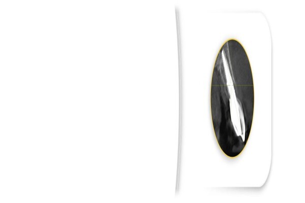 Southern Implants (Pty) Ltd