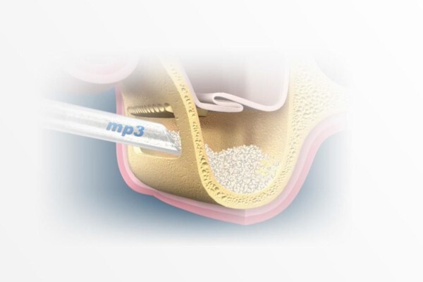 Southern Implants (Pty) Ltd