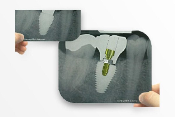 Southern Implants (Pty) Ltd