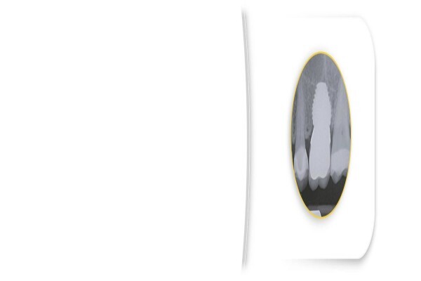 Southern Implants (Pty) Ltd