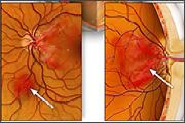 Casoojee Optometrist