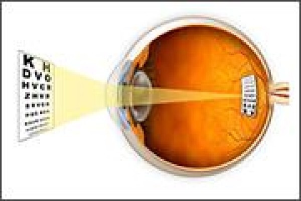 Casoojee Optometrist