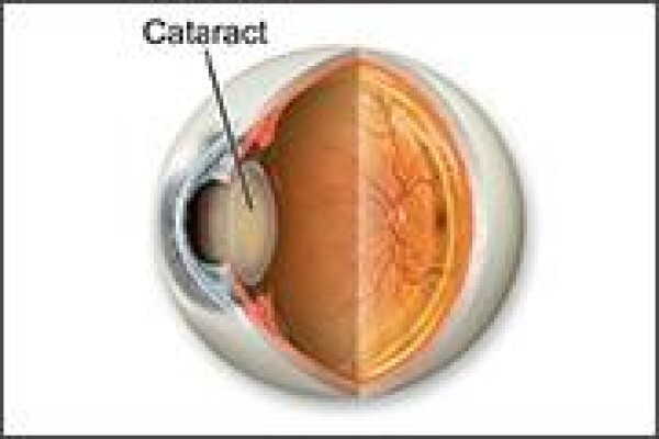 Casoojee Optometrist