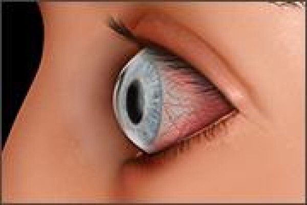 Casoojee Optometrist