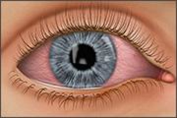 Casoojee Optometrist