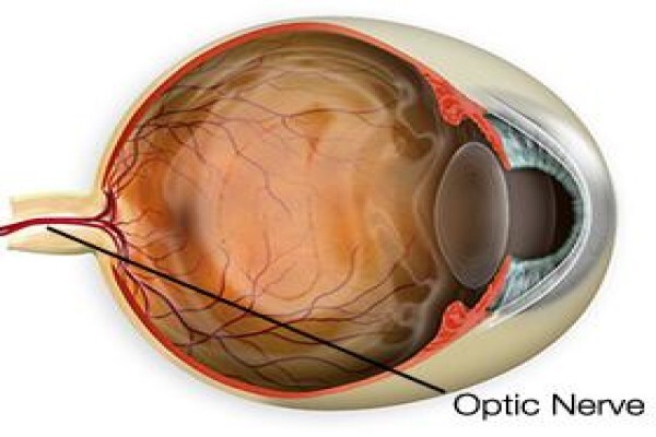 Casoojee Optometrist