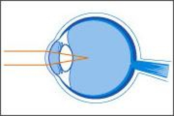 Casoojee Optometrist