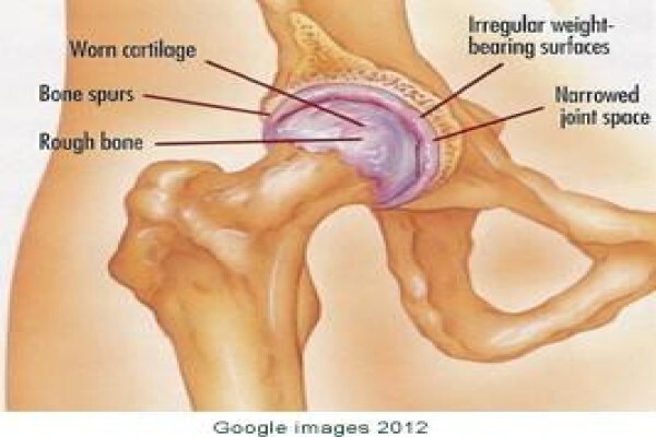 Cape Hip & Knee