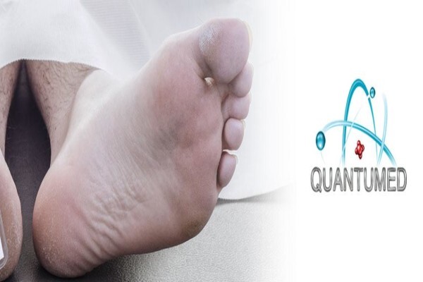 Quantumed