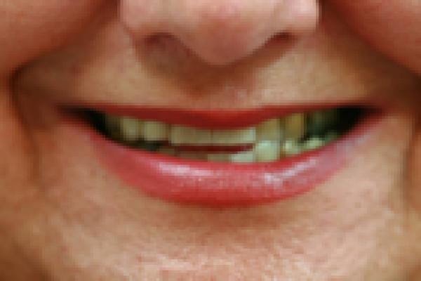 Aesthetic Dentist