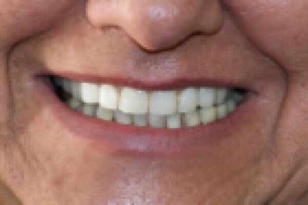 Aesthetic Dentist