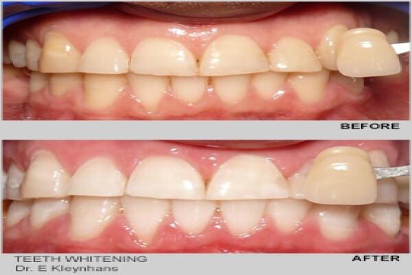 Smile Connection Dental Studio