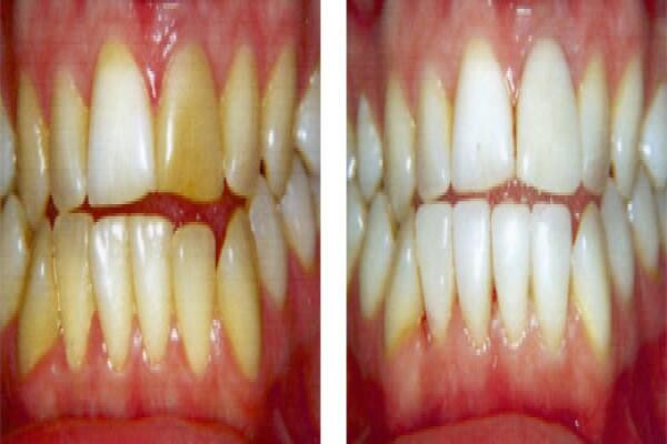 DENTAL - DURBAN:MJ WINDISCH:Res