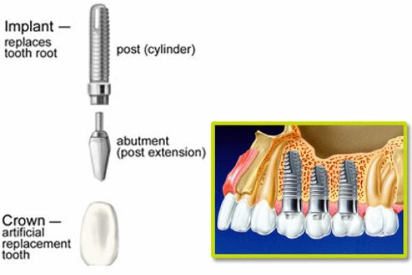 DENTAL - KNYSNA:Jan Zonnestein:Emergency Cell