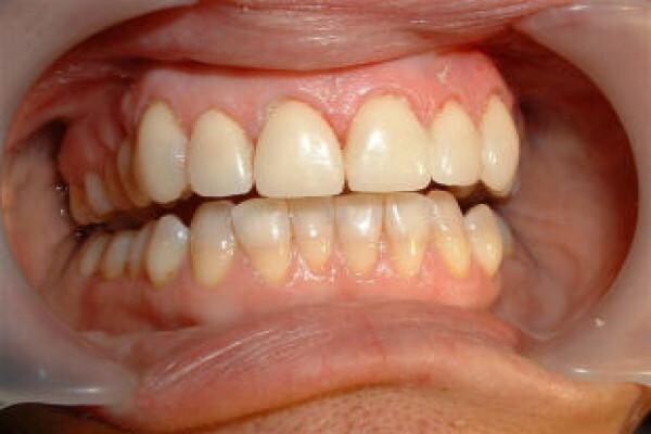 DENTAL - KNYSNA:Jan Zonnestein:Emergency Cell