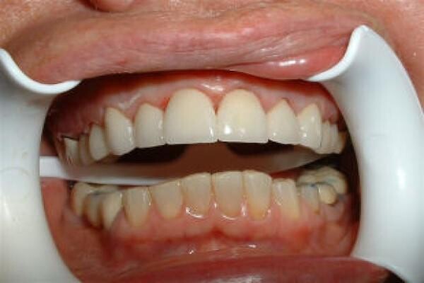 DENTAL - KNYSNA:Jan Zonnestein:Emergency Cell