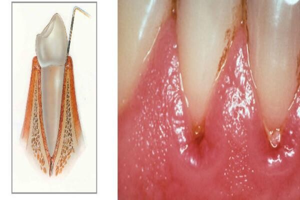 DENTAL - KNYSNA:Jan Zonnestein:Emergency Cell
