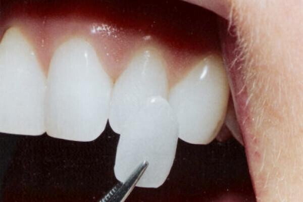 DENTAL - KNYSNA:Jan Zonnestein:Emergency Cell