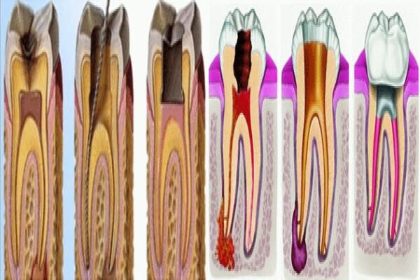 DENTAL - KNYSNA:Jan Zonnestein:Emergency Cell