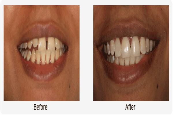 Denticare Dental Surgeries