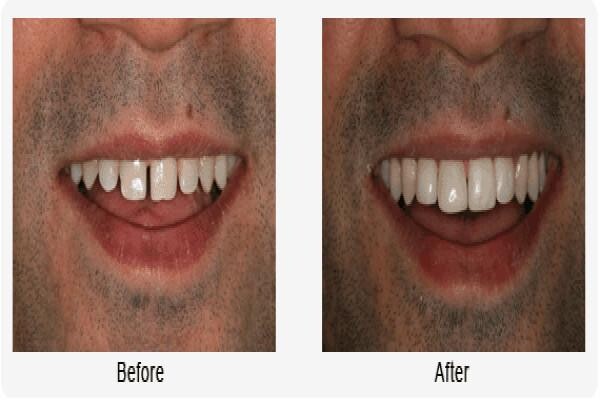 Denticare Dental Surgeries
