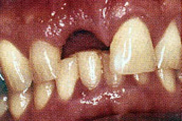 DENTAL - DURBAN:D L Booyse