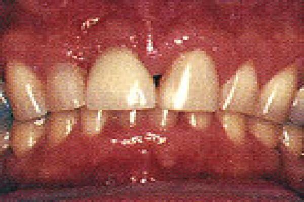 DENTAL - DURBAN:D L Booyse