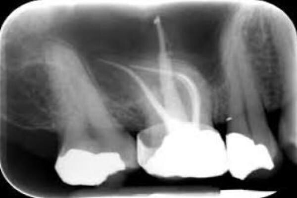 Dr Larika Robb (Dentist Newcastle)