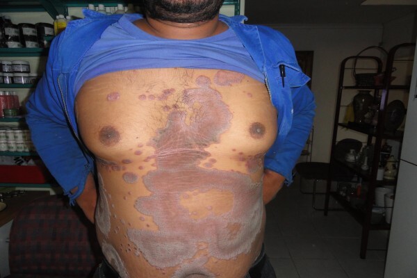Herbal Force Skin Clinic