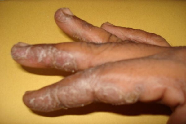 Herbal Force Skin Clinic