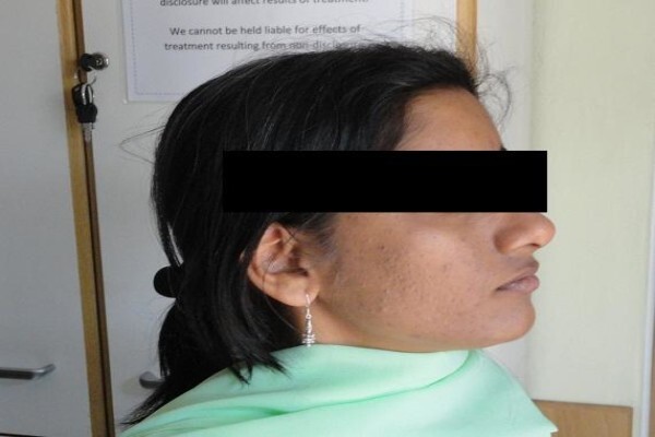 Herbal Force Skin Clinic