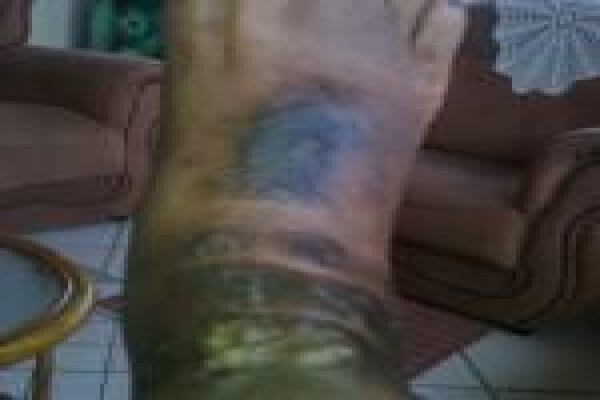 Herbal Force Skin Clinic