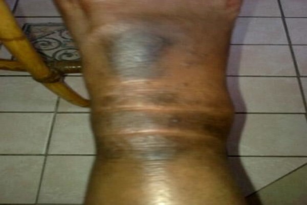 Herbal Force Skin Clinic