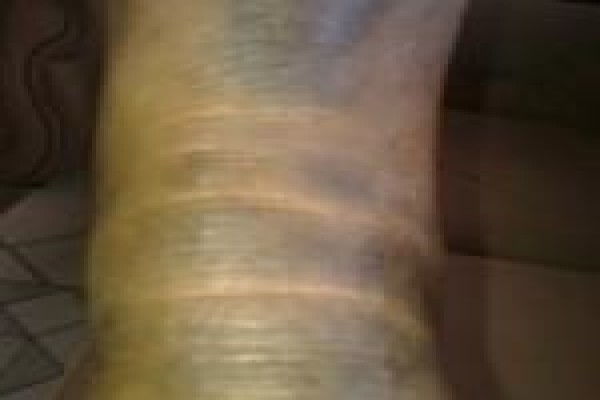 Herbal Force Skin Clinic