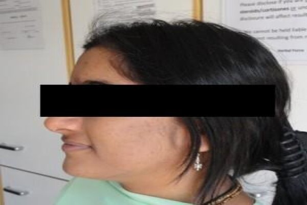 Herbal Force Skin Clinic