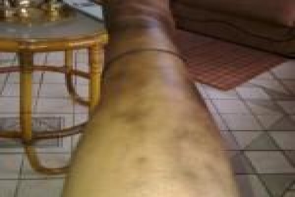 Herbal Force Skin Clinic