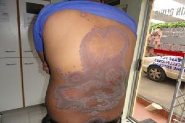 Herbal Force Skin Clinic